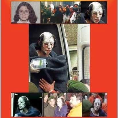 Бирсен Карс2